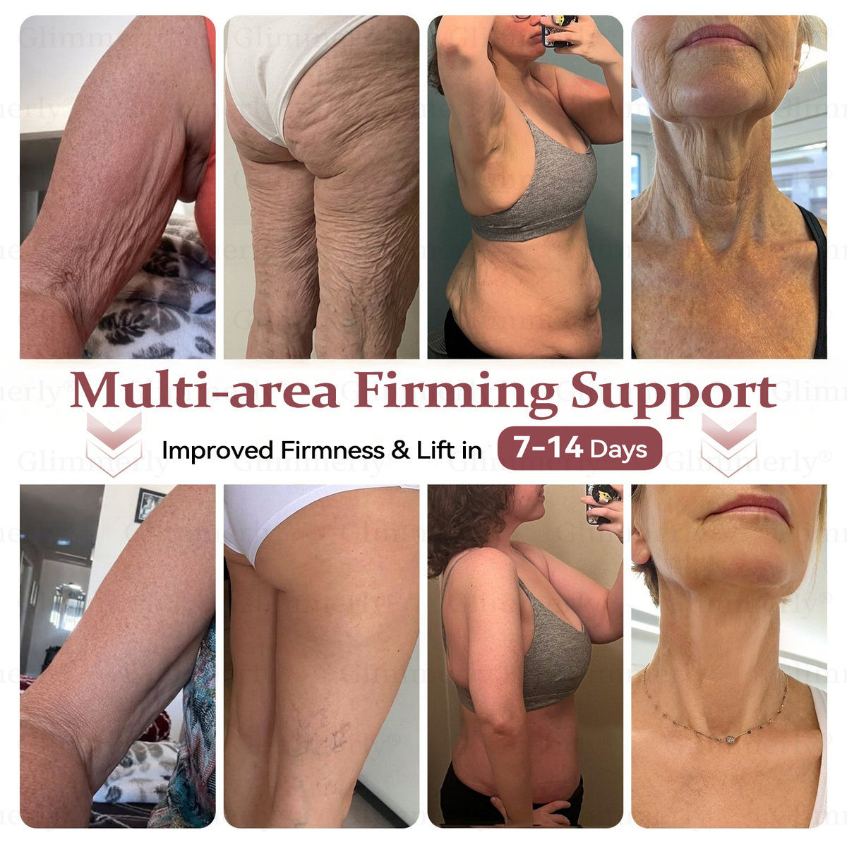 💦𝐆𝐥𝐢𝐦𝐦𝐞𝐫𝐥𝐲® 𝐁𝐫𝐞𝐚𝐬𝐭 𝐕𝐨𝐥𝐮𝐦𝐞 𝐁𝐨𝐨𝐬𝐭 & 𝐅𝐢𝐫𝐦 𝐌𝐢𝐜𝐫𝐨-𝐍𝐞𝐞𝐝𝐥𝐞 𝐏𝐚𝐭𝐜𝐡𝐞𝐬 💦