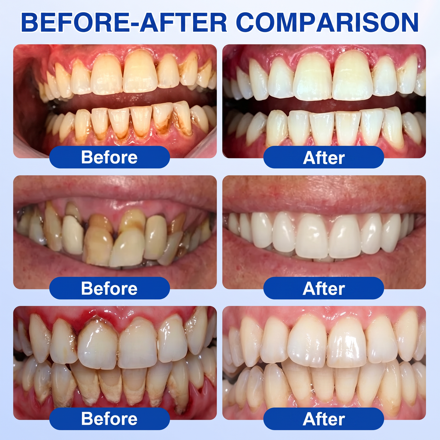 🇮🇪Glimmerly® 🎺GumRevive periodontal repair gel