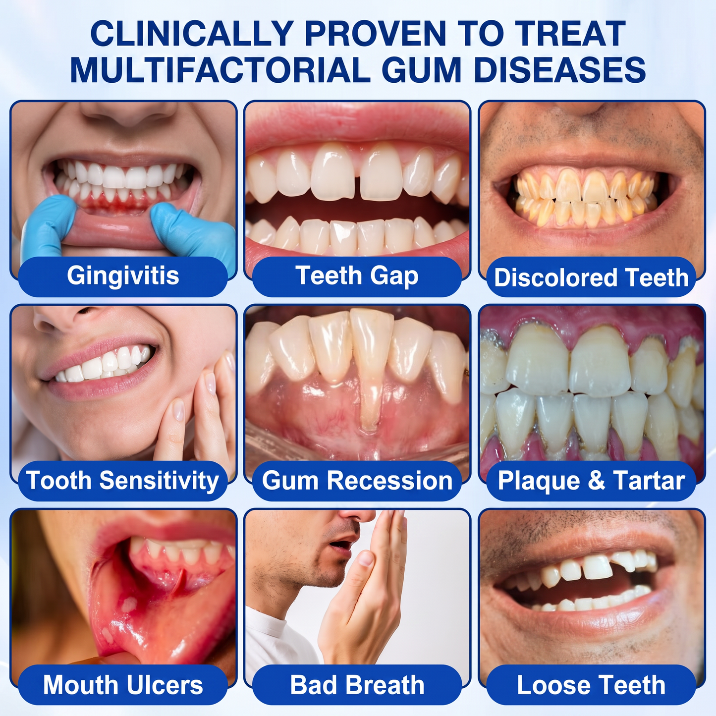 🇮🇪Glimmerly® 🎺GumRevive periodontal repair gel