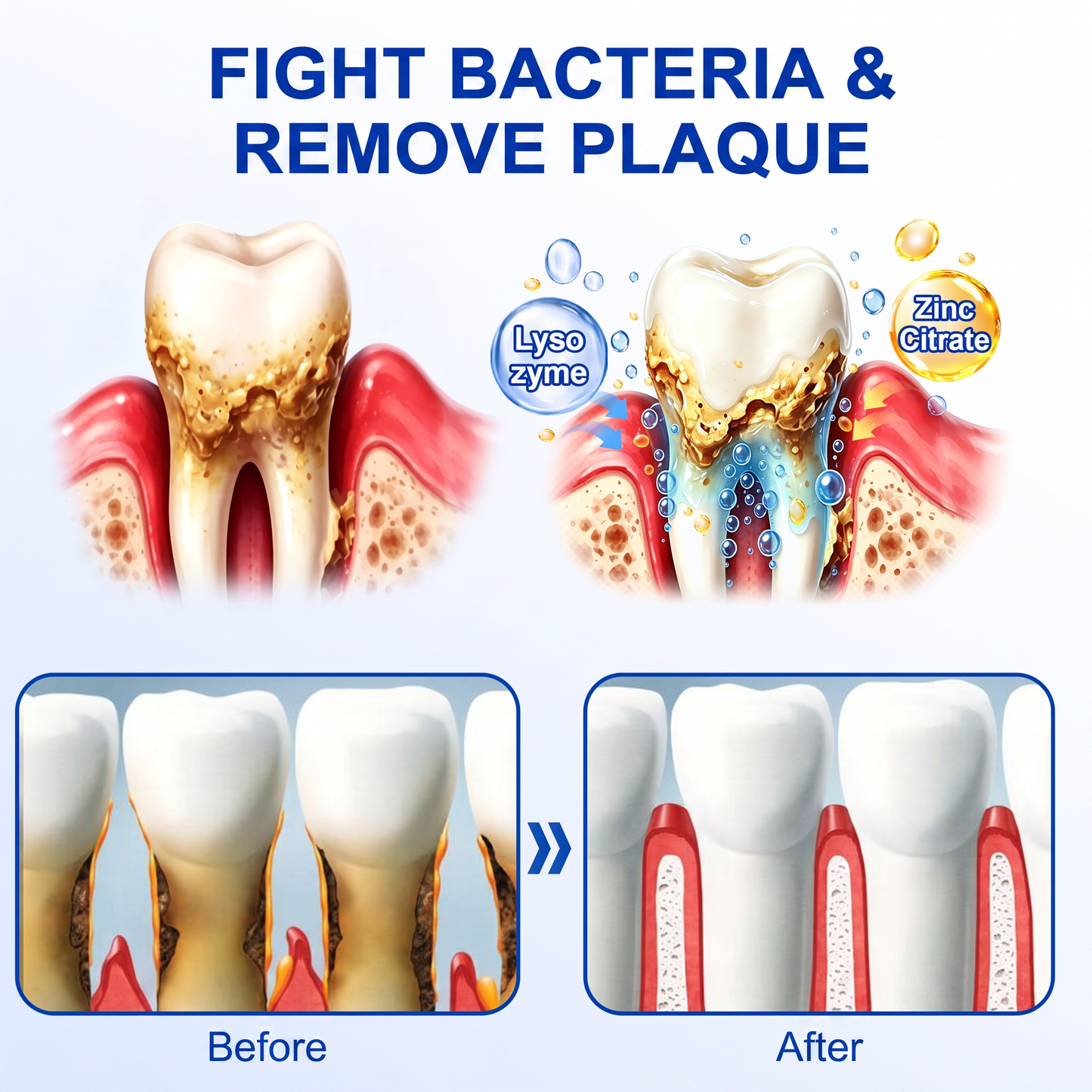 🇮🇪Glimmerly® 🎺GumRevive periodontal repair gel