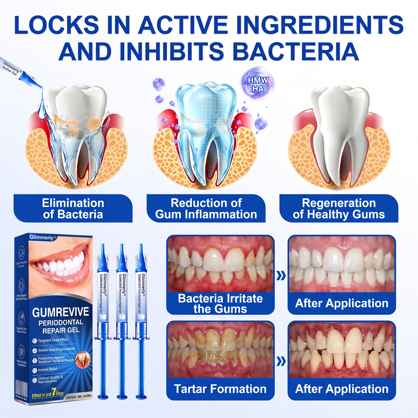 🇮🇪Glimmerly® 🎺GumRevive periodontal repair gel