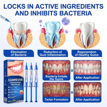 🇮🇪Glimmerly® 🎺GumRevive periodontal repair gel