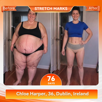 𝐎𝐟𝐟𝐢𝐜𝐢𝐚𝐥 𝐁𝐫𝐚𝐧𝐝 𝐒𝐭𝐨𝐫𝐞🥇𝐏𝐀𝐔𝐑𝐀𝐉𝐔® 𝟐𝟎𝟐𝟔 𝐌𝐨𝐫𝐢𝐧𝐠𝐚 & 𝐁𝐞𝐫𝐛𝐞𝐫𝐢𝐧𝐞 𝟒-𝐈𝐧-𝟏 𝐌𝐢𝐜𝐫𝐨-𝐏𝐚𝐫𝐭𝐢𝐜𝐥𝐞 𝐒𝐜𝐮𝐥𝐩𝐭𝐢𝐧𝐠 & 𝐅𝐚𝐭-𝐁𝐮𝐫𝐧 𝐒𝐡𝐨𝐫𝐭𝐬🌻